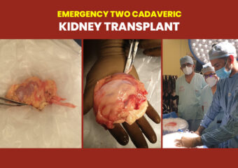 Kidney Transplant