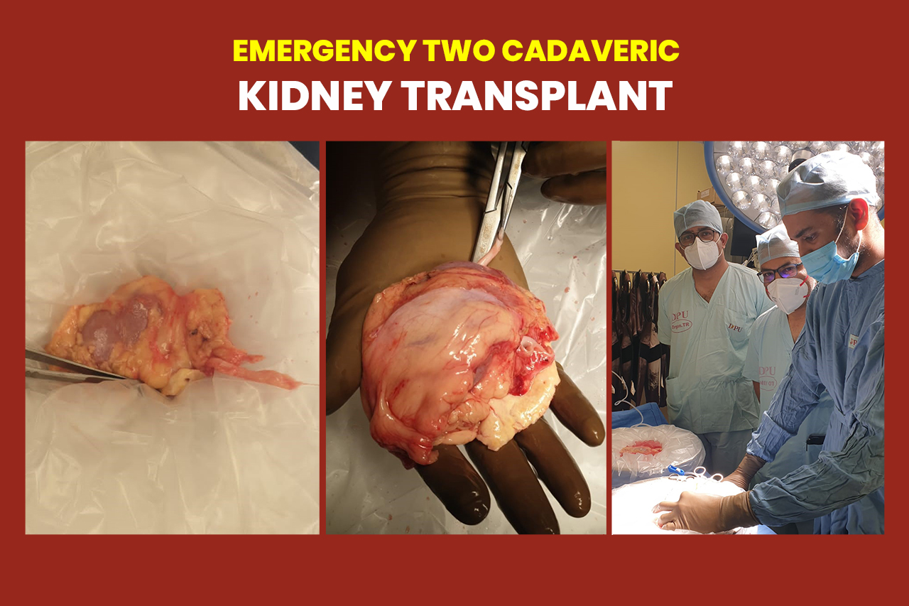 Emergency Two Cadveric Kidney Transplant
